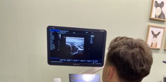 USG Bioderek u Niemowląt