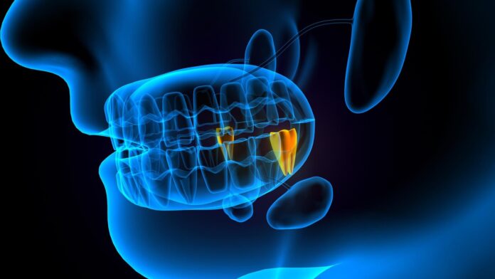 Gdzie zamówić skanowanie wycisków zębowych
